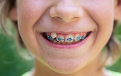 What Is the Best Age to Get Braces for Kids?